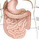 An illustration of the woman’s rare condition, situs inversus with levocardia